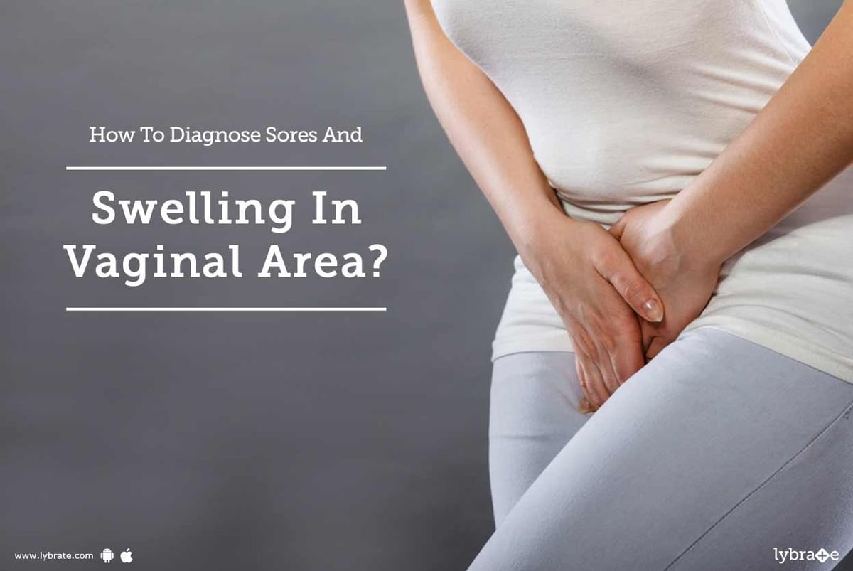 How To Diagnose Sores And Swelling In Vaginal Area By Dr Purnima Jain Lybrate 