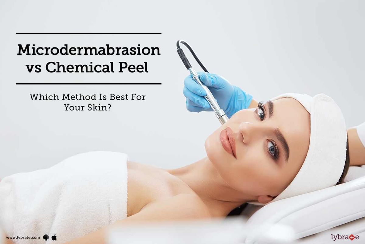 Microdermabrasion Vs Chemical Peel - Which Method Is Best For Your Skin ...