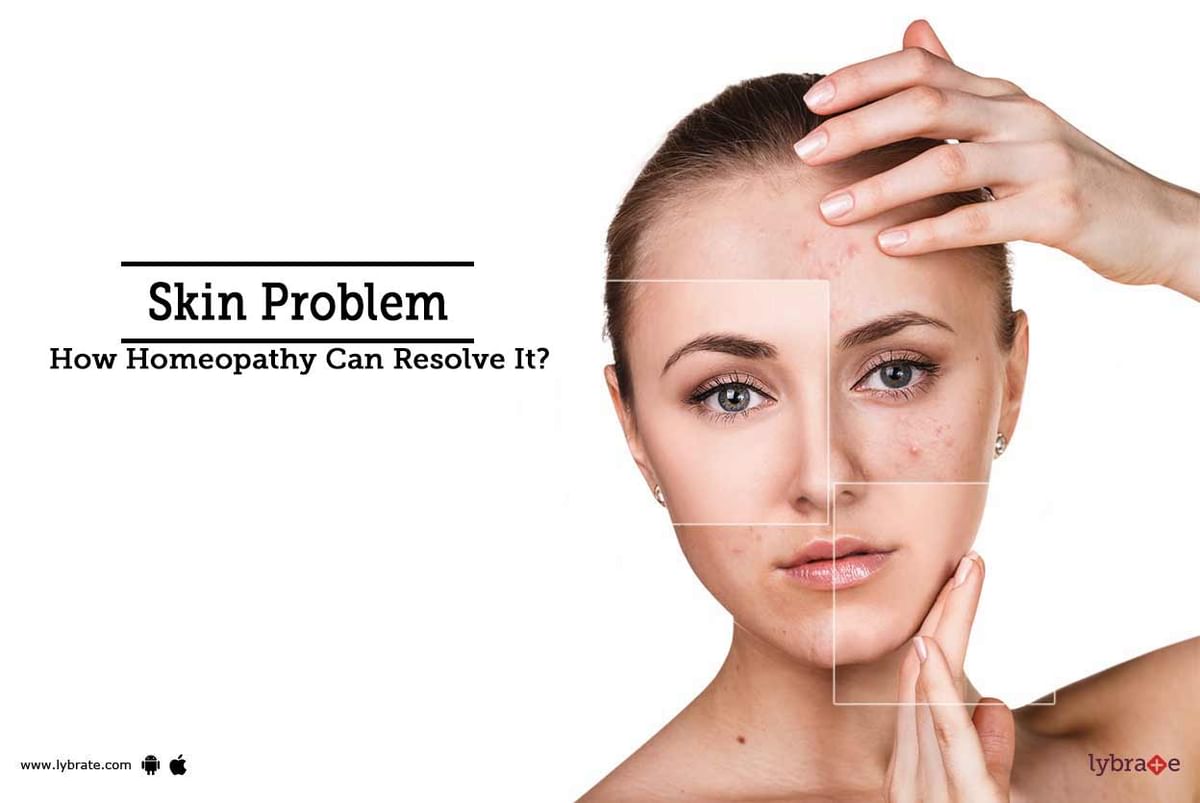 Skin Problem - How Homeopathy Can Resolve It? - By Dr. Anusha Vivek ...