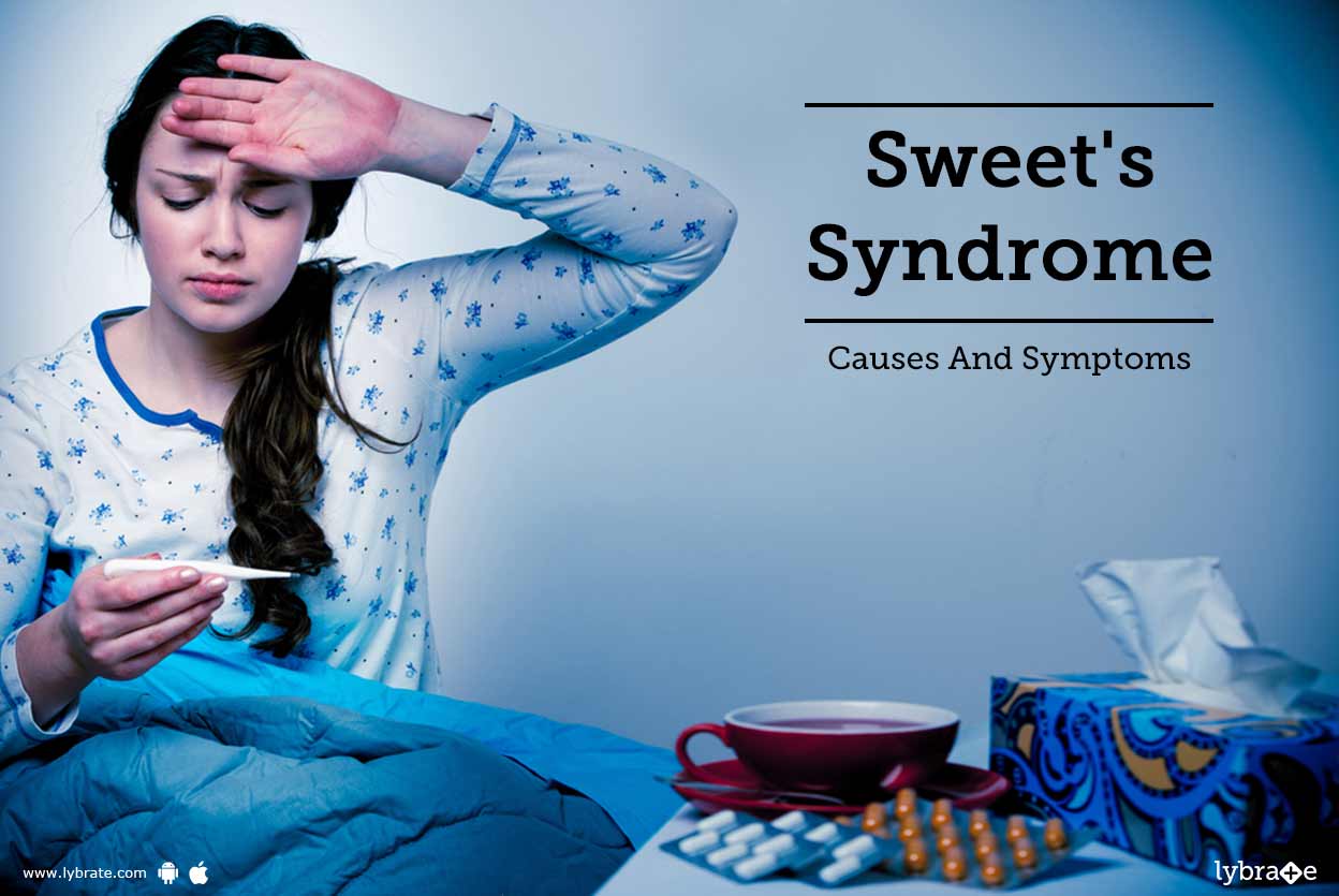 Sweet's Syndrome Causes And Symptoms By Dr. Pradeep Kumari Lybrate