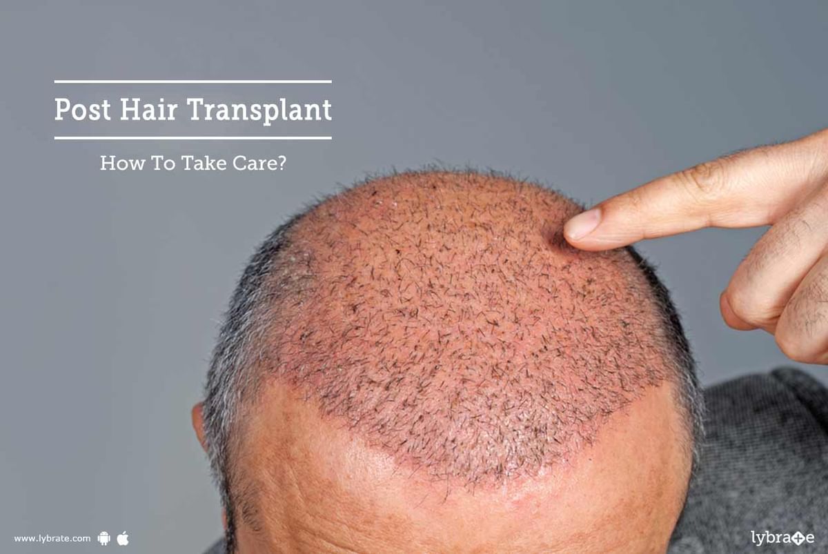 Post Hair Transplant - How To Take Care? - By Cosmetica Skin Laser & Hair  Transplant Centre | Lybrate