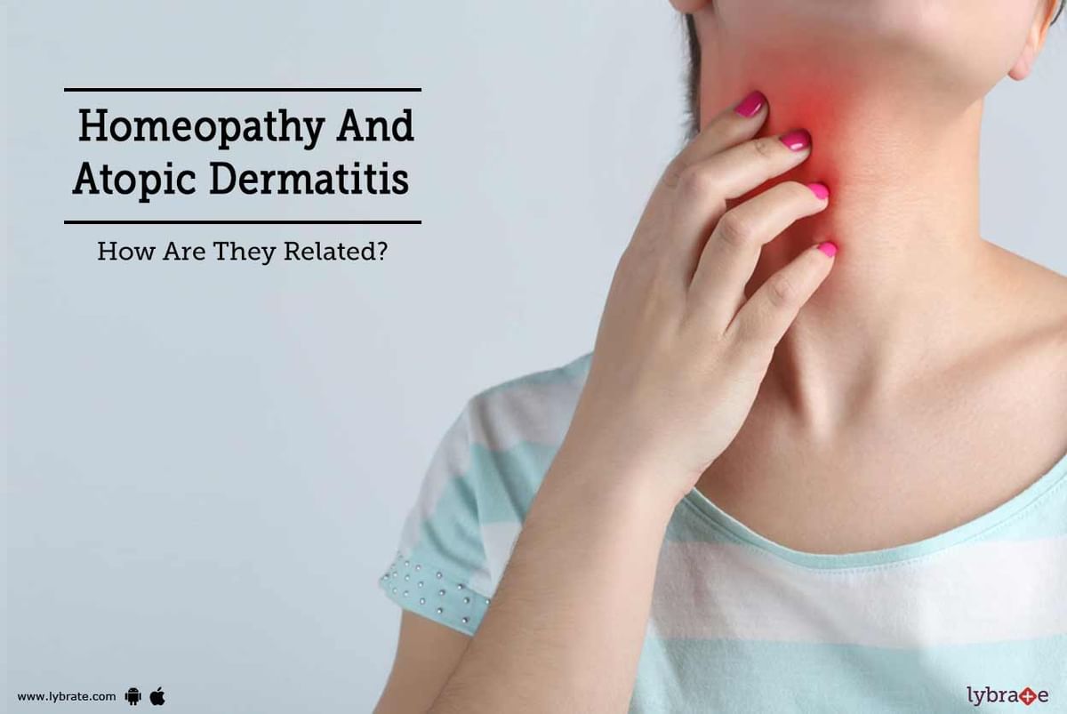 Homeopathy And Atopic Dermatitis How Are They Related By Dr Jagdish Gupta Lybrate