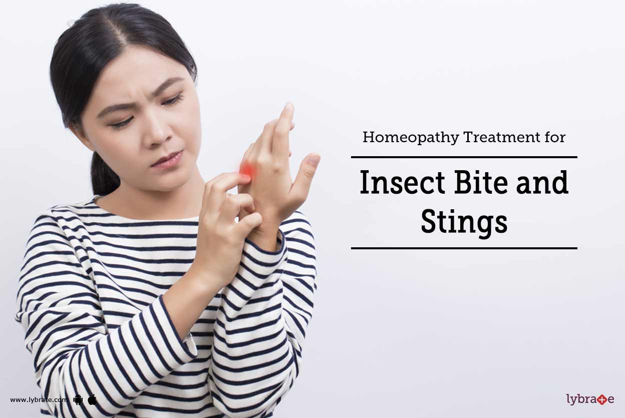 Homeopathy Treatment For Insect Bite And Stings By Dr. Jay Verma