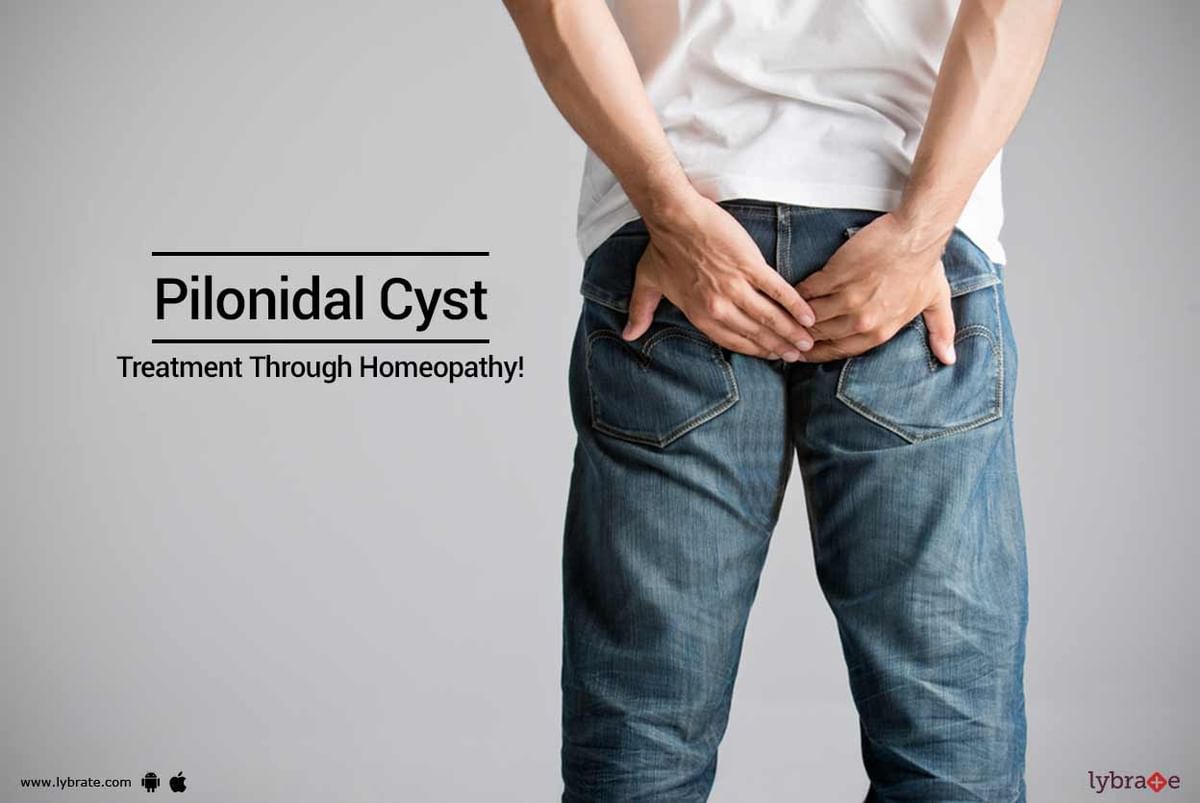 Pilonidal Cyst - Causes, Symptoms & Treatment in Homeopathy