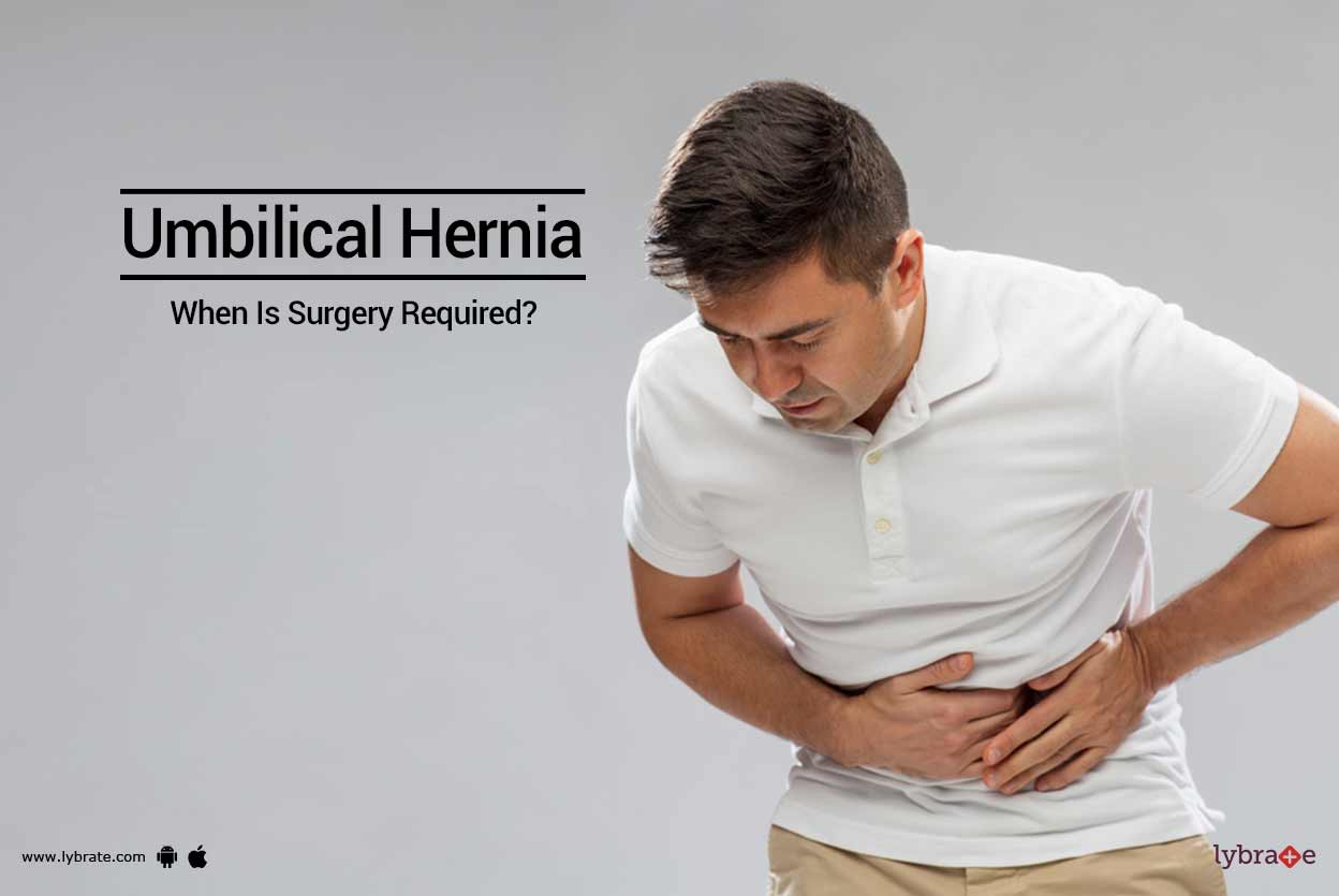 Umbilical Hernia When Is Surgery Required? By Dr. Puneet Gupta