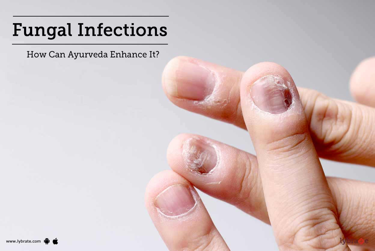 Fungal Infections Homeopathic Ways Of Getting Them Treated! By Dr