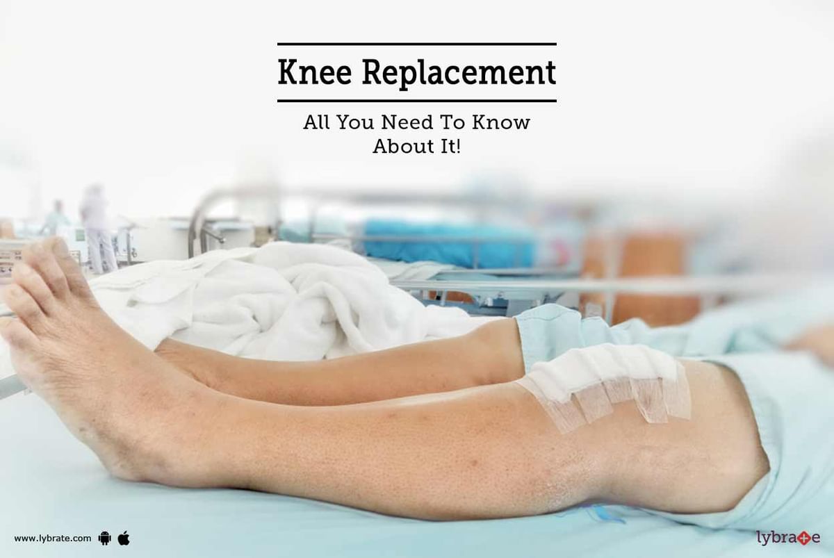 What Are The Signs That You Need Knee Replacement