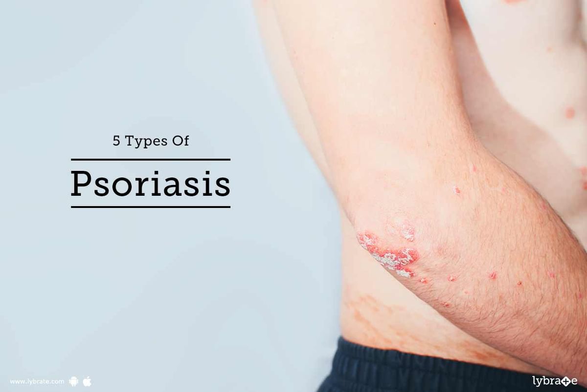 5 Types Of Psoriasis - By Dr. Nitin Jain | Lybrate