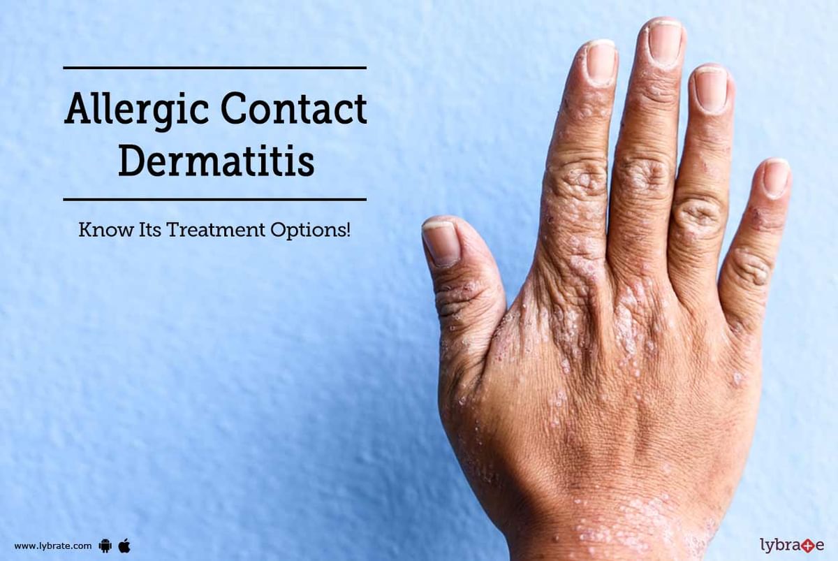 Allergic Contact Dermatitis Know Its Treatment Options By Dr