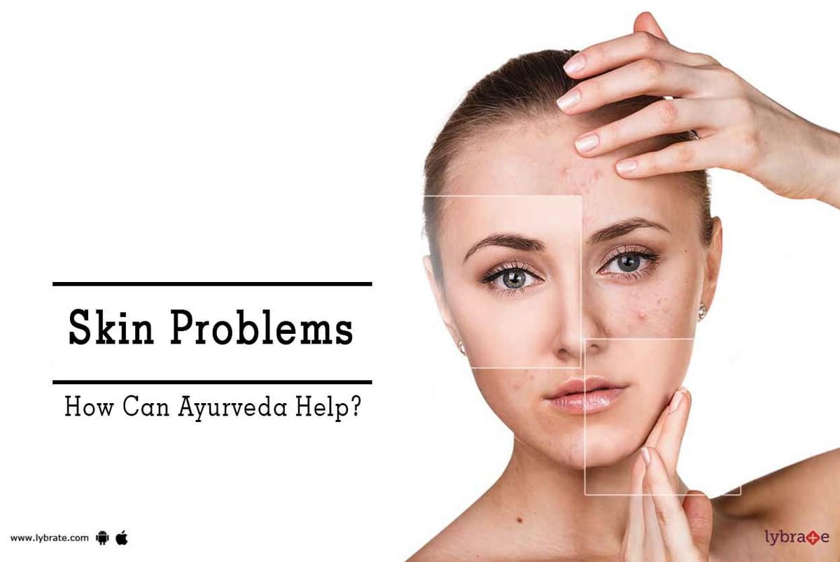 Skin Problems - How Can Ayurveda Help? - By Dr. Ashutosh Sharma | Lybrate