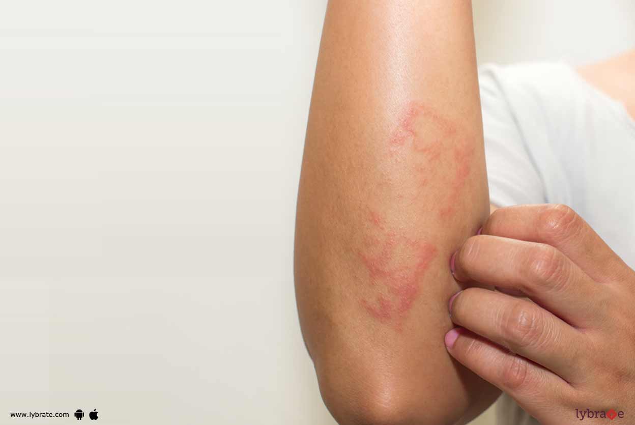 Keratosis Pilaris What Are The Symptoms Of It? By Dr. Govind Sahay Lybrate