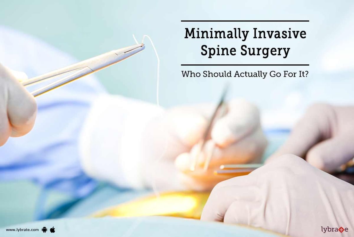 Minimally Invasive Spine Surgery - Who Should Actually Go For It? - By ...