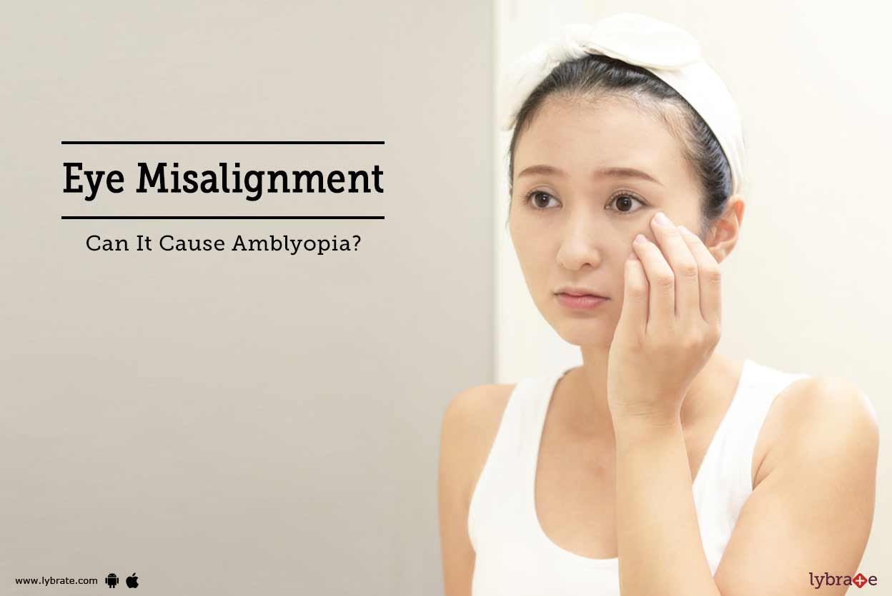 Eye Misalignment Can It Cause Amblyopia? By Asg Eye Hospital Lybrate