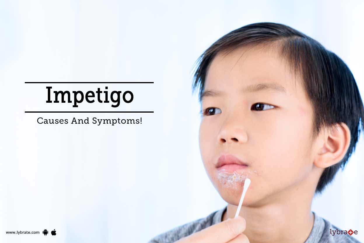 Impetigo Causes And Symptoms! By Dr. Esha Agarwal Lybrate