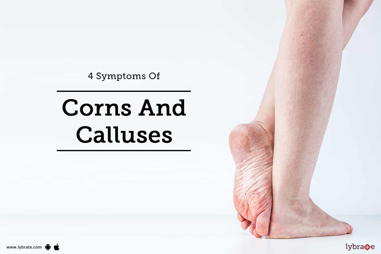 4 Symptoms Of Corns And Calluses By Dr. Nitin Jain Lybrate