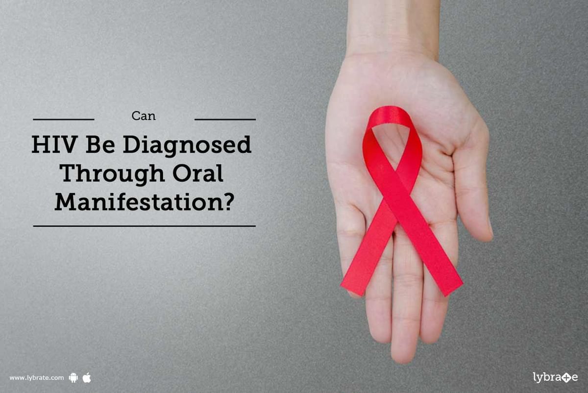 Can HIV Be Diagnosed Through Oral Manifestation? - By Dr. M. Vijaya ...