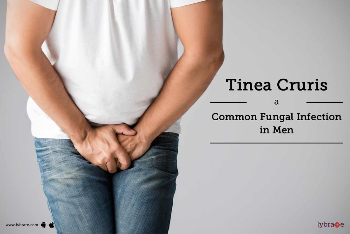 Tinea Cruris A Common Fungal Infection In Men By Dr Sumit Sethi Lybrate 7327