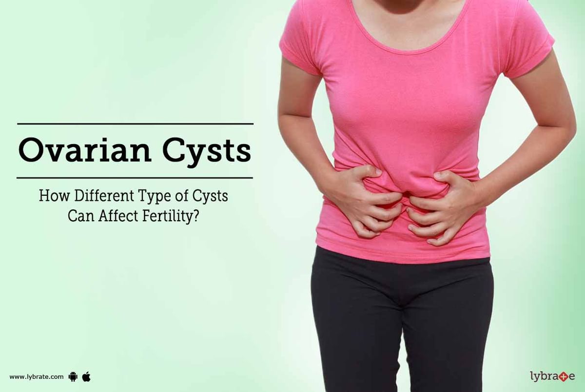 Ovarian Cysts How Different Type Of Cysts Can Affect Fertility By Dr Prabha Singla Lybrate