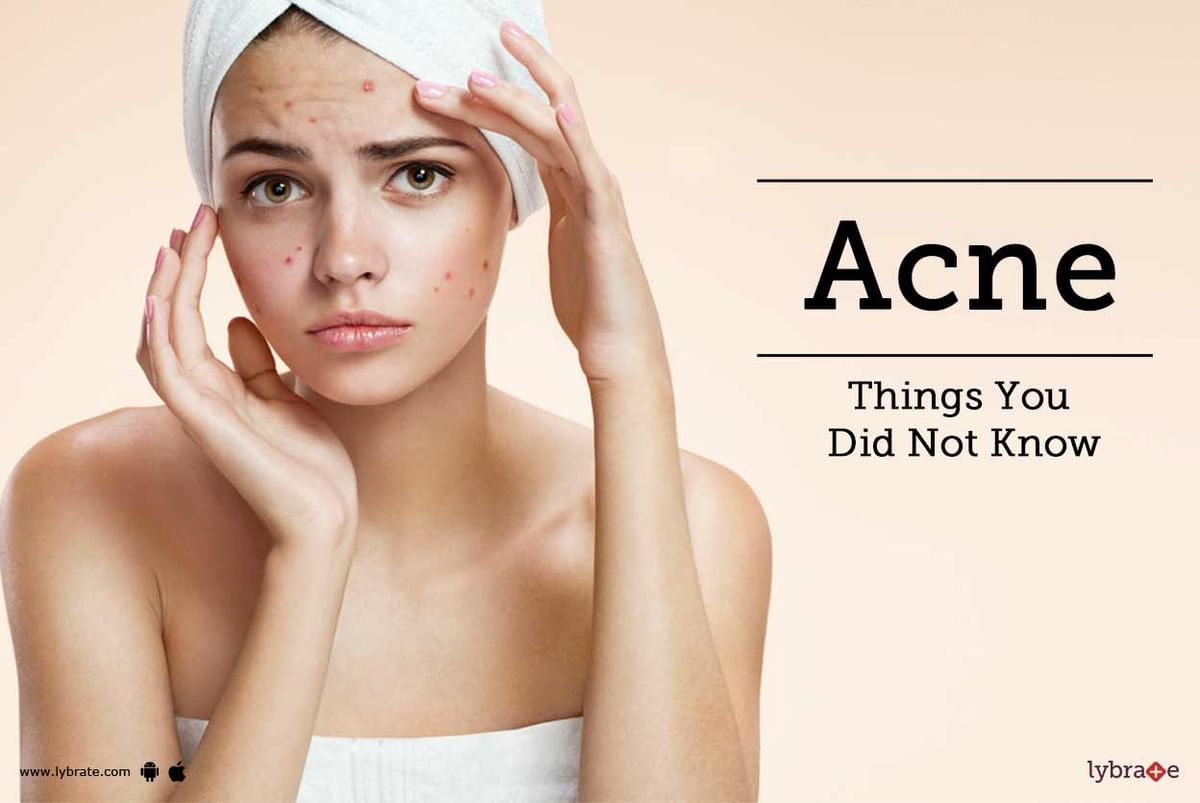 Acne: Things You Did Not Know - By Dr. Poonam Tiwari | Lybrate