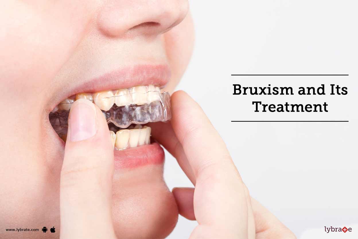 Bruxism and Its Treatment By Dr. Nishi Tandon Lybrate