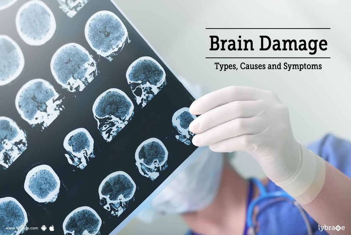 Brain Damage - Types, Causes and Symptoms - By Dr. Satyajit Das | Lybrate