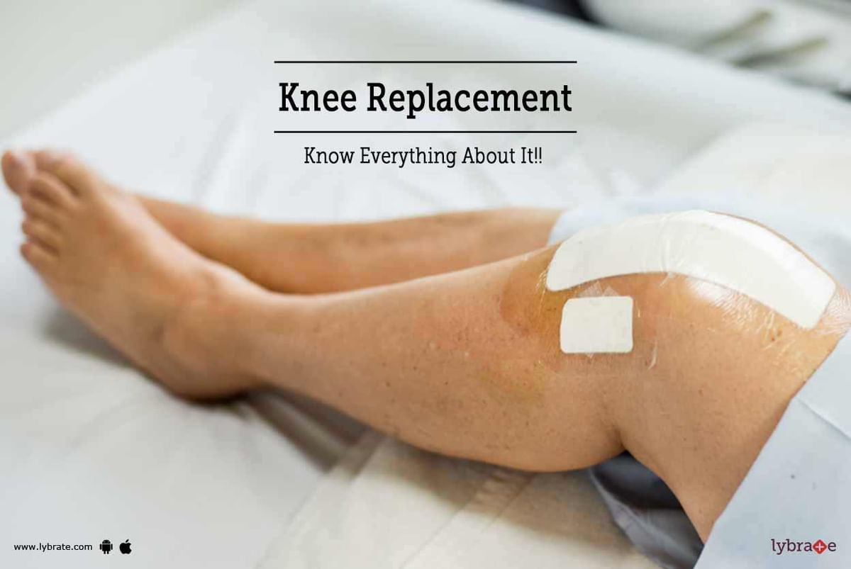 Knee Replacement Know Everything About It By Dr Hardeek N   C24043 