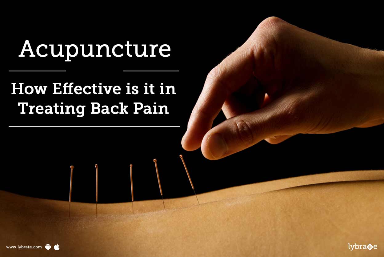 Acupuncture How Effective is it in Treating Back Pain By Dr. M.N