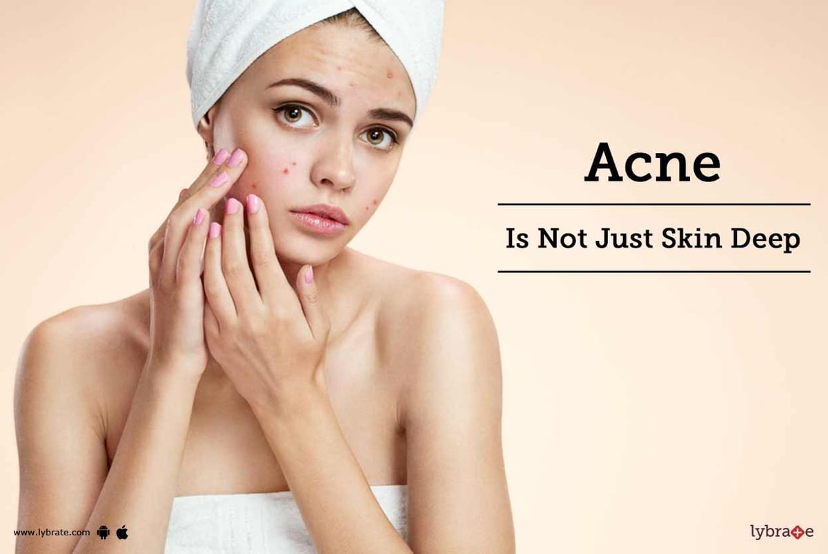 Acne Is Not Just Skin Deep - By Dr. Atul Taneja | Lybrate