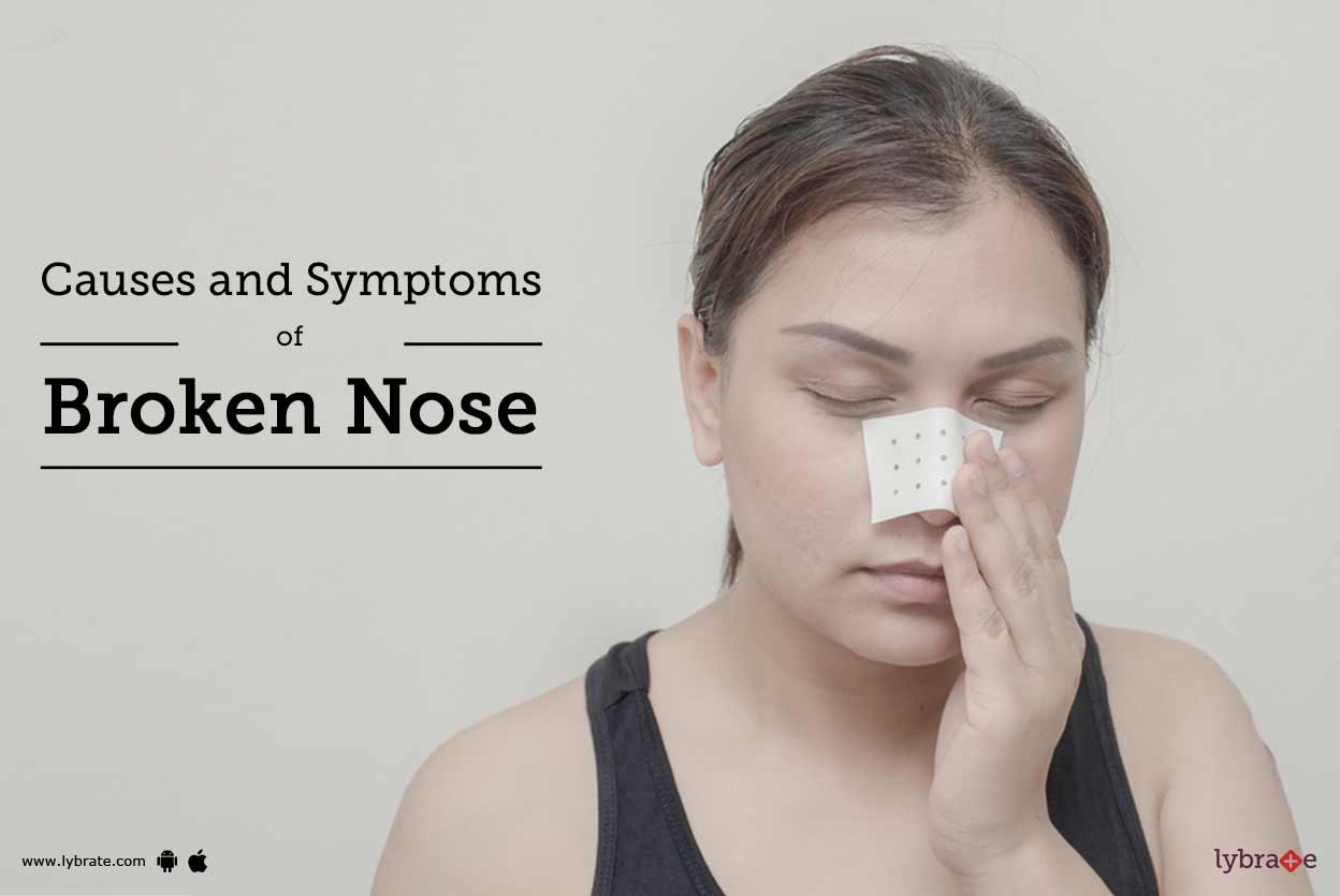 Broken Nose Causes And Symptoms! By Gaurav Shekhar Lybrate atelier