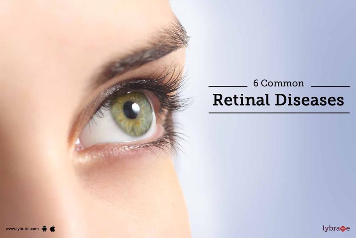 6 Common Retinal Diseases - By Dr. Tejas D. Shah | Lybrate