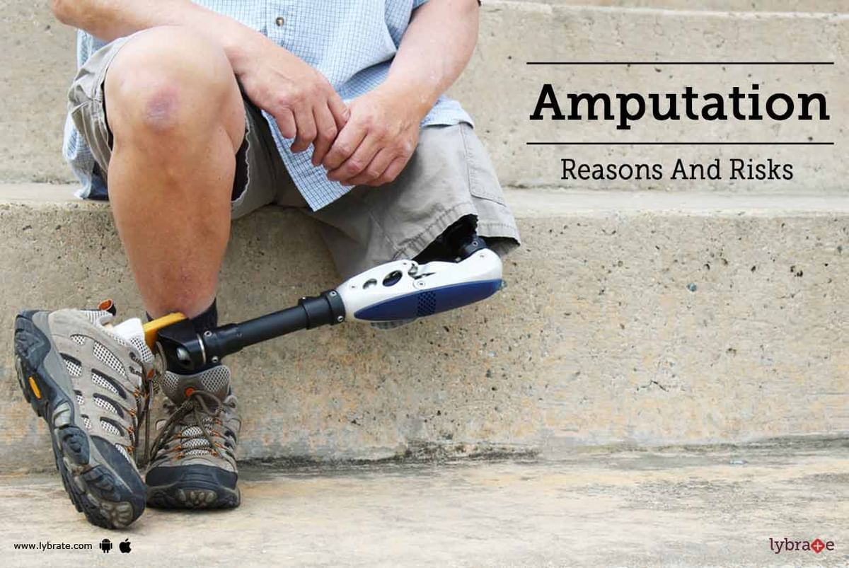 Amputation - Reasons And Risks - By Dr. Aastha Midha Likhyani | Lybrate