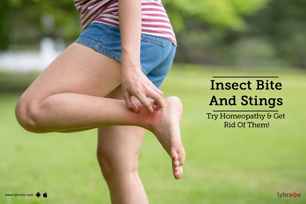 Insect Bite And Stings Try Homeopathy & Get Rid Of Them! By Homoeo