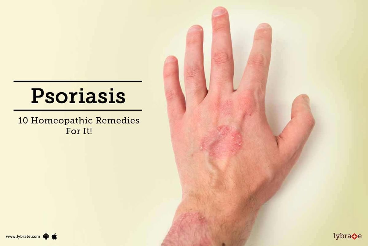 Psoriasis 10 Homeopathic Remedies For It By Dr Jeevangouda