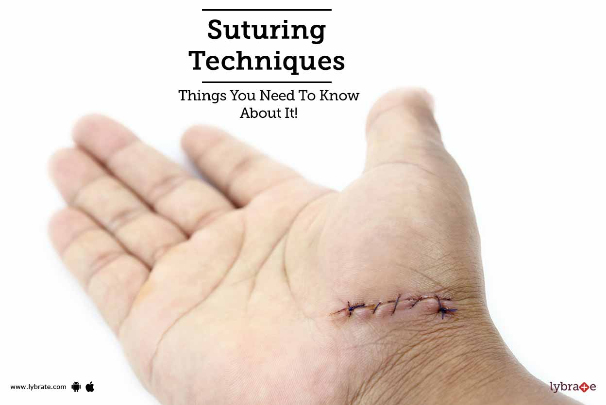 Suturing Techniques Things You Need To Know About It! By Dr
