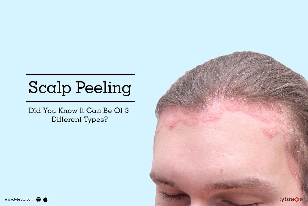 Scalp Peeling - It Can Be Of 3 Different Types? - By Looks Forever Hair And  Skin Aesthetic Clinic | Lybrate