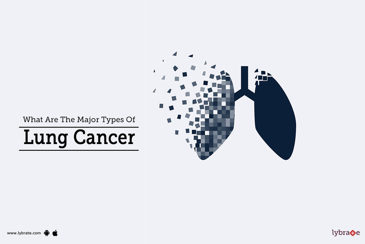 what-are-the-major-types-of-lung-cancer-by-dr-harpreet-singh-lybrate