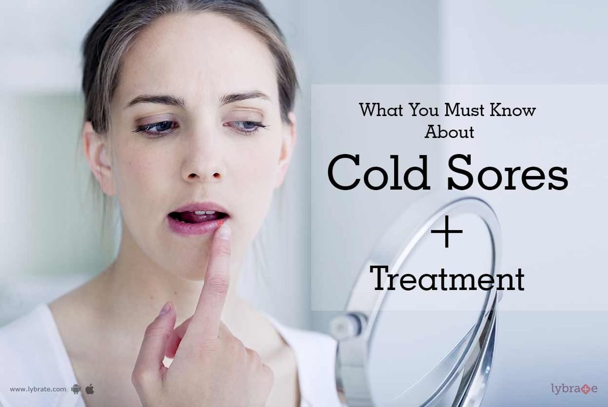 What You Must Know About Cold Sores + Treatment - By Dr. Rohit Batra ...