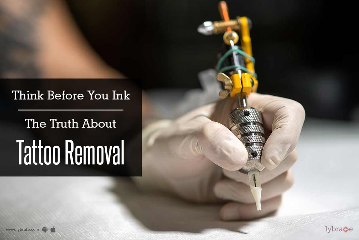 Does Tattoo Removal Work? | Find Out Here | Tattoo Removal Institute