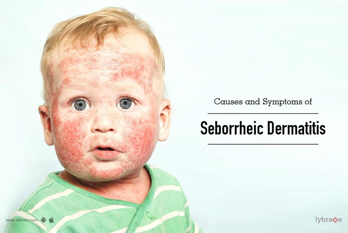 Causes and Symptoms of Seborrheic Dermatitis - By Dr. Ganesh Avhad ...