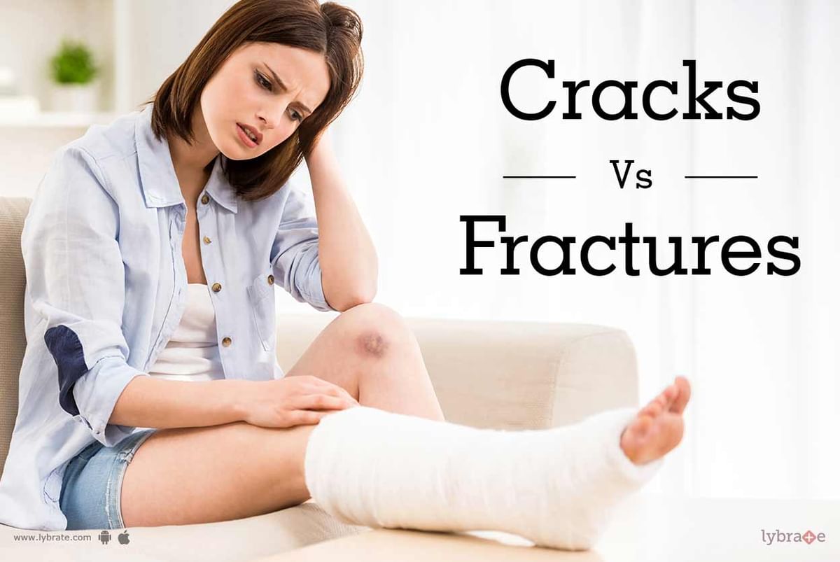 Cracks VS Fractures - By Dr. Rajesh Kumar Verma | Lybrate