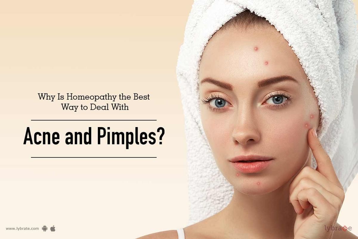 Why Is Homeopathy The Best Way To Deal With Acne And Pimples? - By Dr 