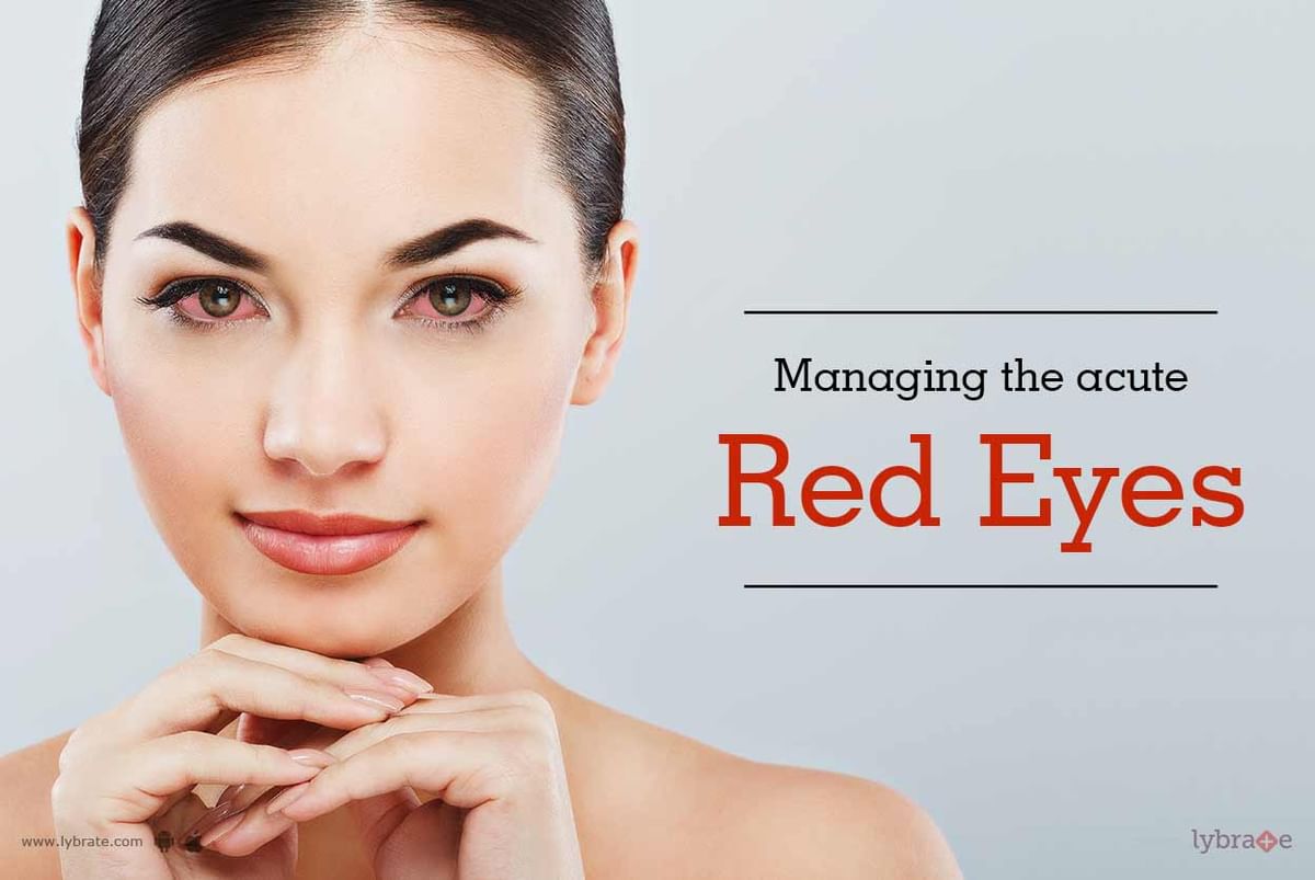 managing-the-acute-red-eye-by-dr-chaitanya-shukla-lybrate