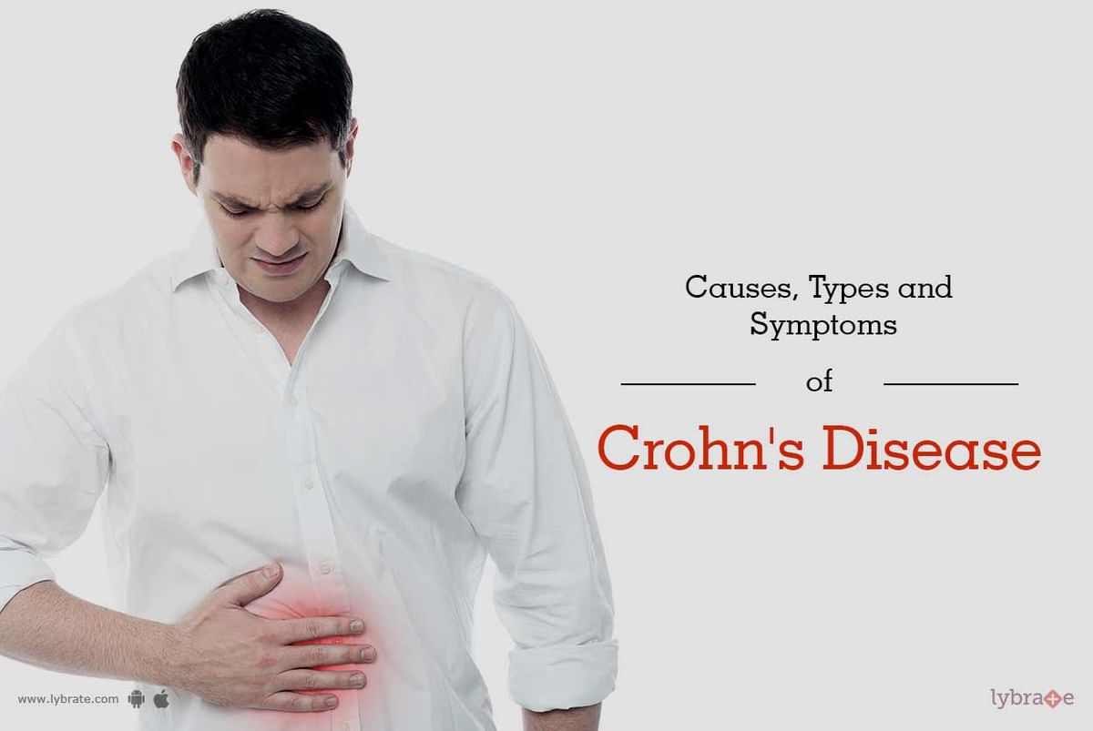 Causes, Types and Symptoms of Crohn's Disease - By Dr. Bhavin Vasavada ...