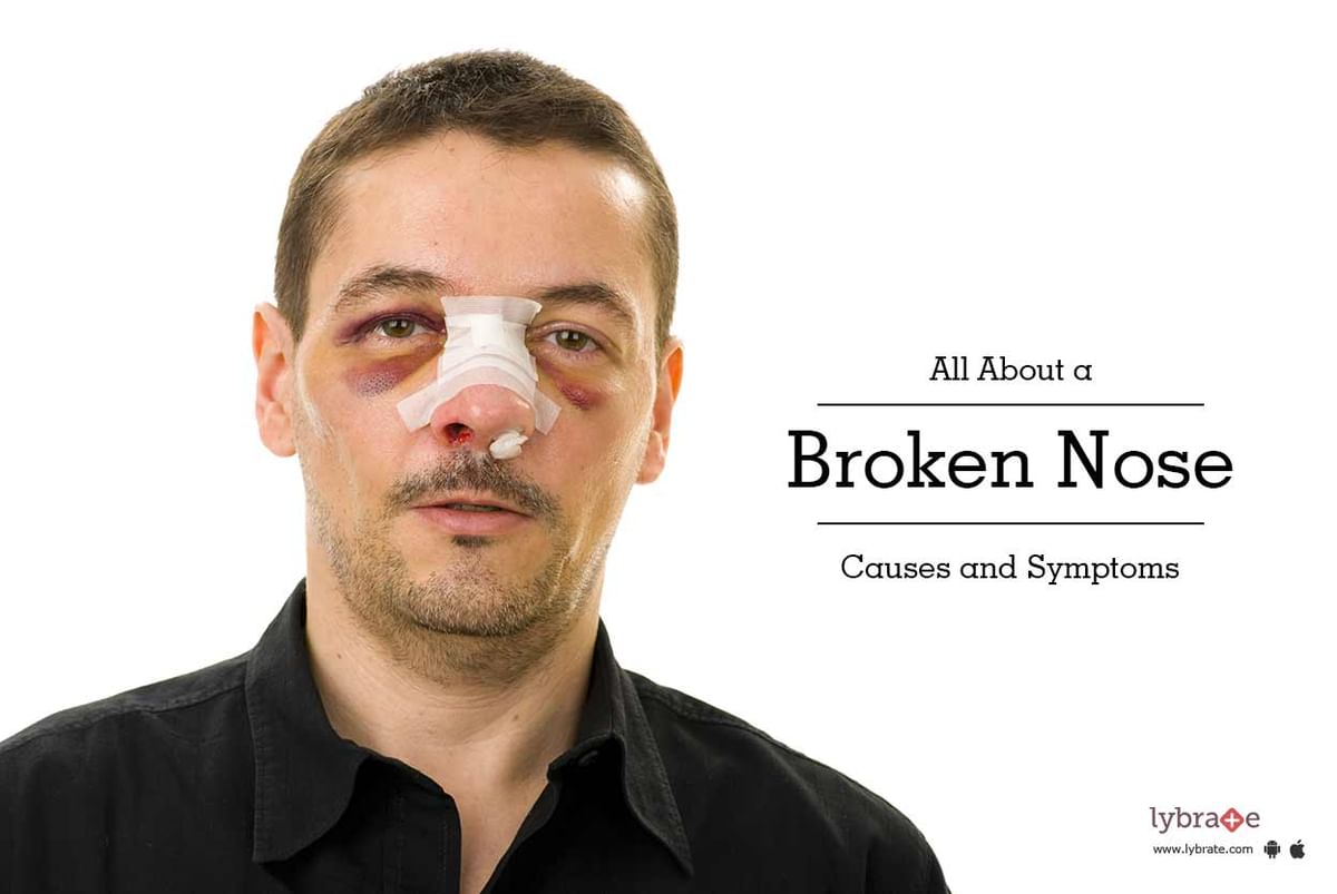 All About A Broken Nose Causes And Symptoms By Dr Shalabh Sharma