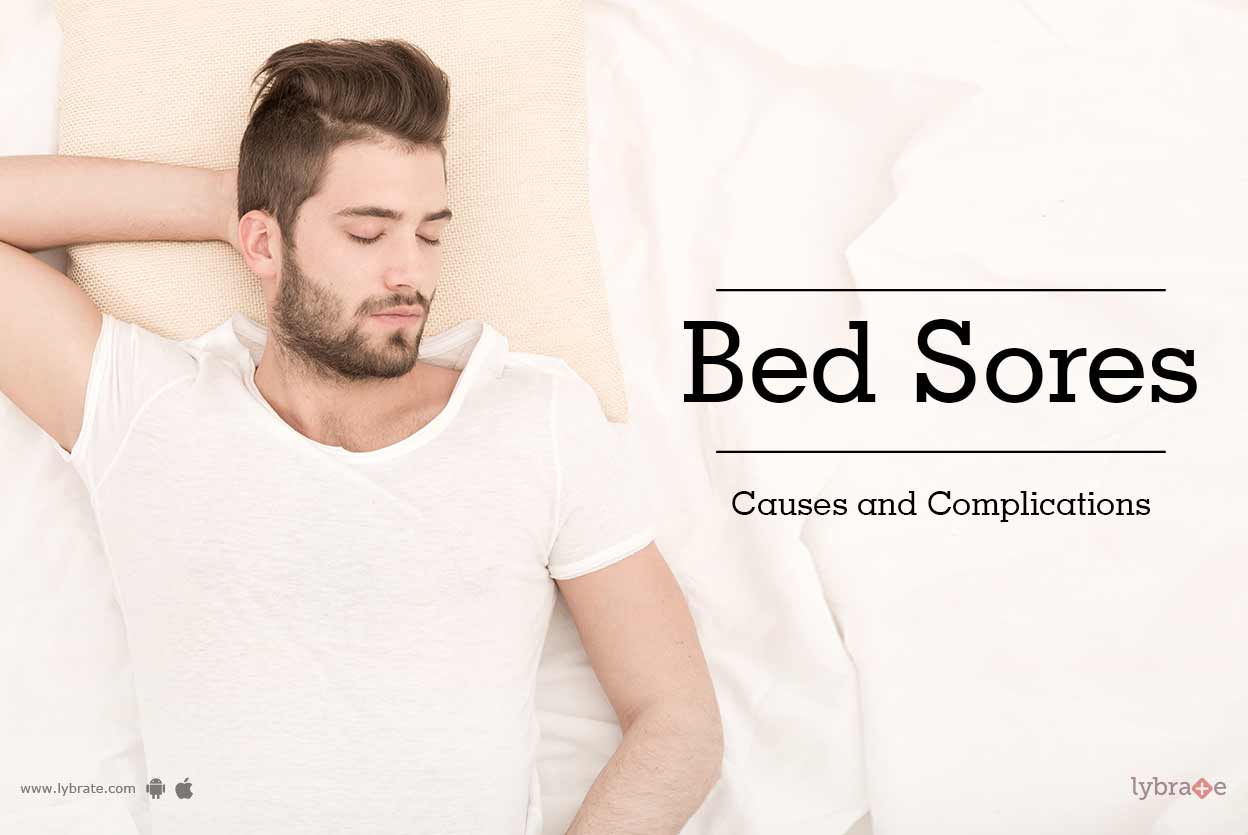 Bed Sores Causes and Complications By Dr. Soni Anand Lybrate