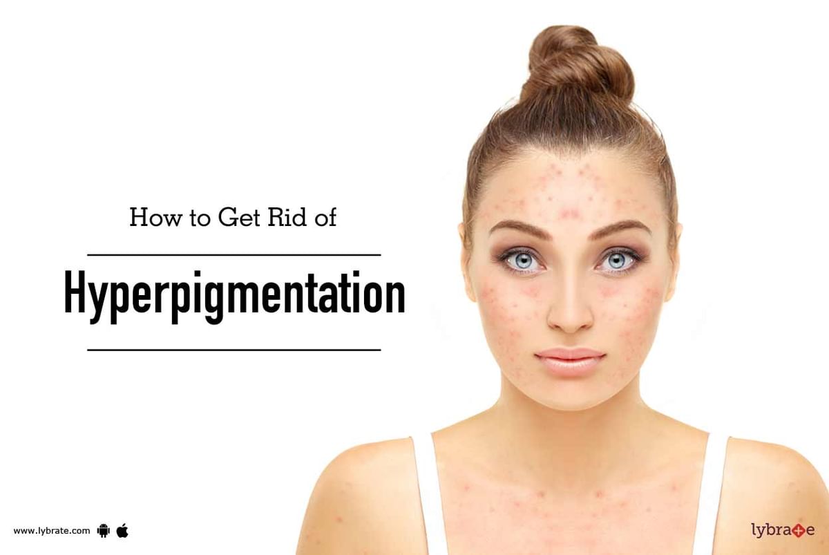 best-ayurvedic-remedies-for-pigmentation-on-face-by-dr-omkar