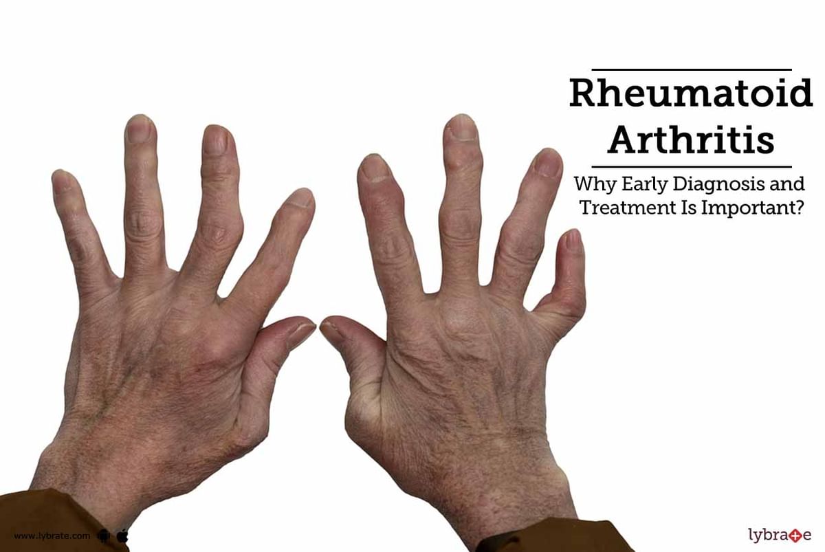 Rheumatoid Arthritis Why Early Diagnosis And Treatment Is Important