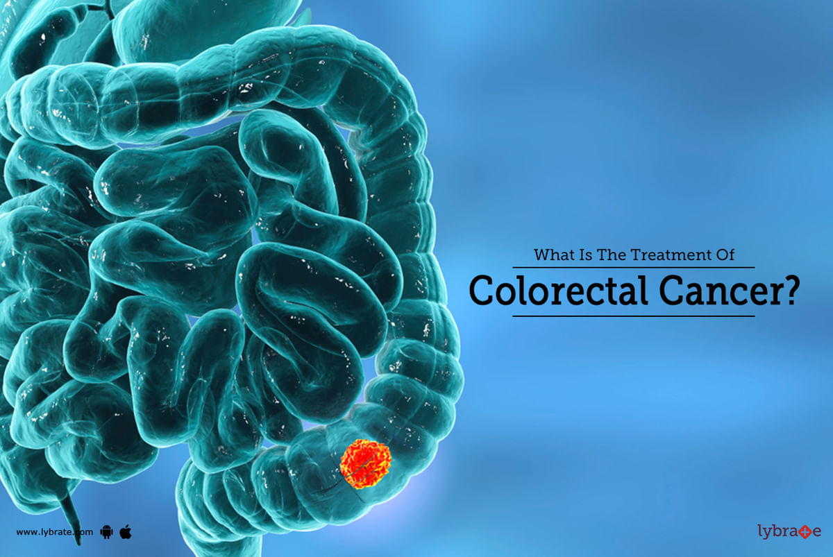 What Is The Treatment Of Colorectal Cancer By Dr Sanjeev Kumar Singh Lybrate 6159