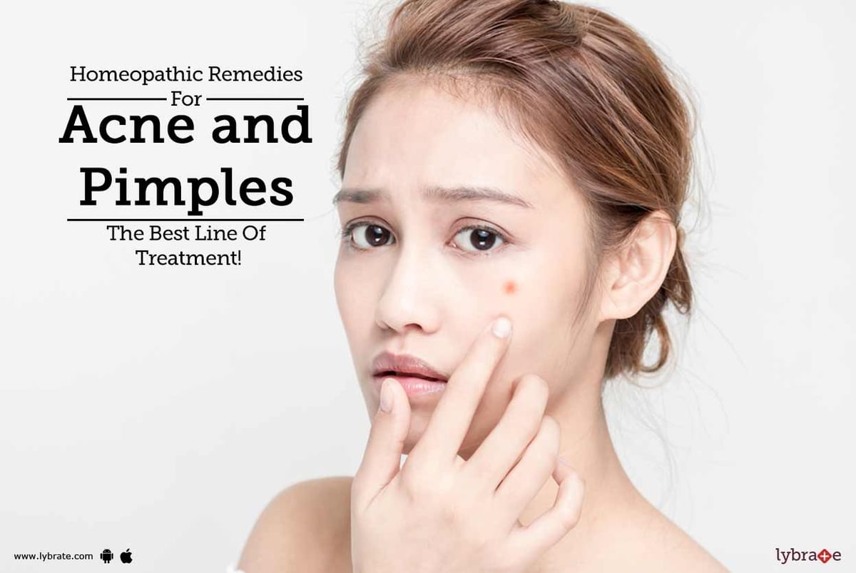 Homeopathic Remedies For Acne and Pimples- The Best Line Of Treatment ...