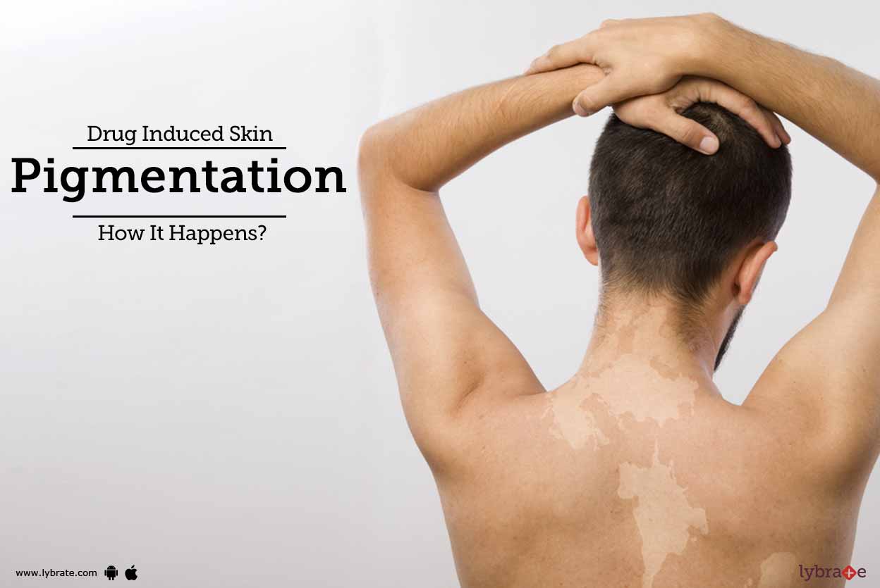 Drug Induced Skin Pigmentation How It Happens? By Dr. Aanchal